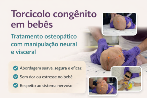 Torcicolo congênito em bebês — manipulação neural e visceral | Baggio Osteopatia