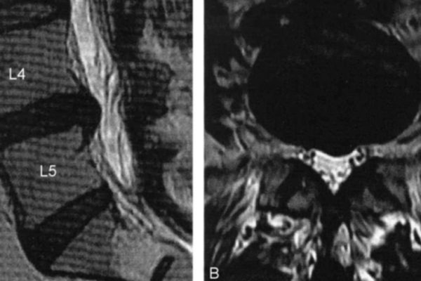 imagem de ressônancia magnética para explicar estudo cientifico publicado na pubmed